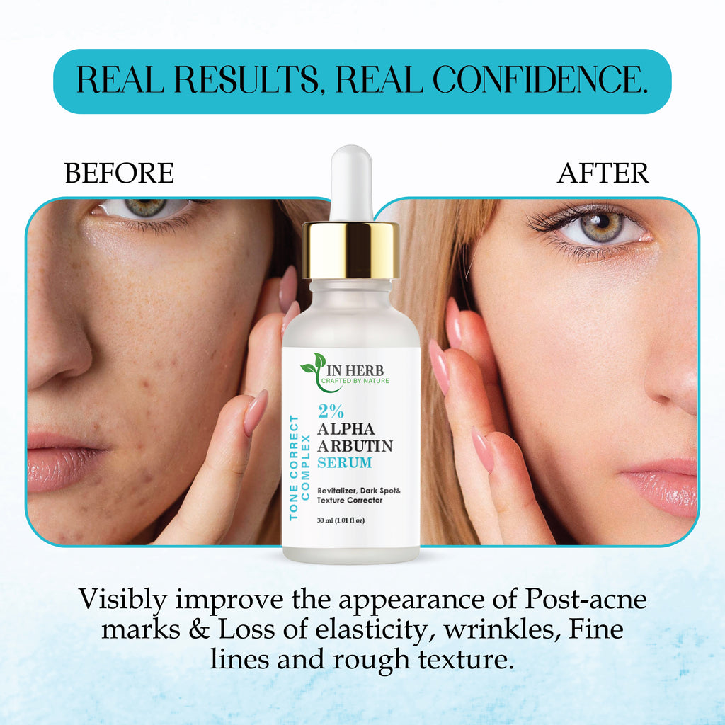 In Herb 2% Alpha Arbutin Serum for Face, Lightweight Daily Use, 30 ml