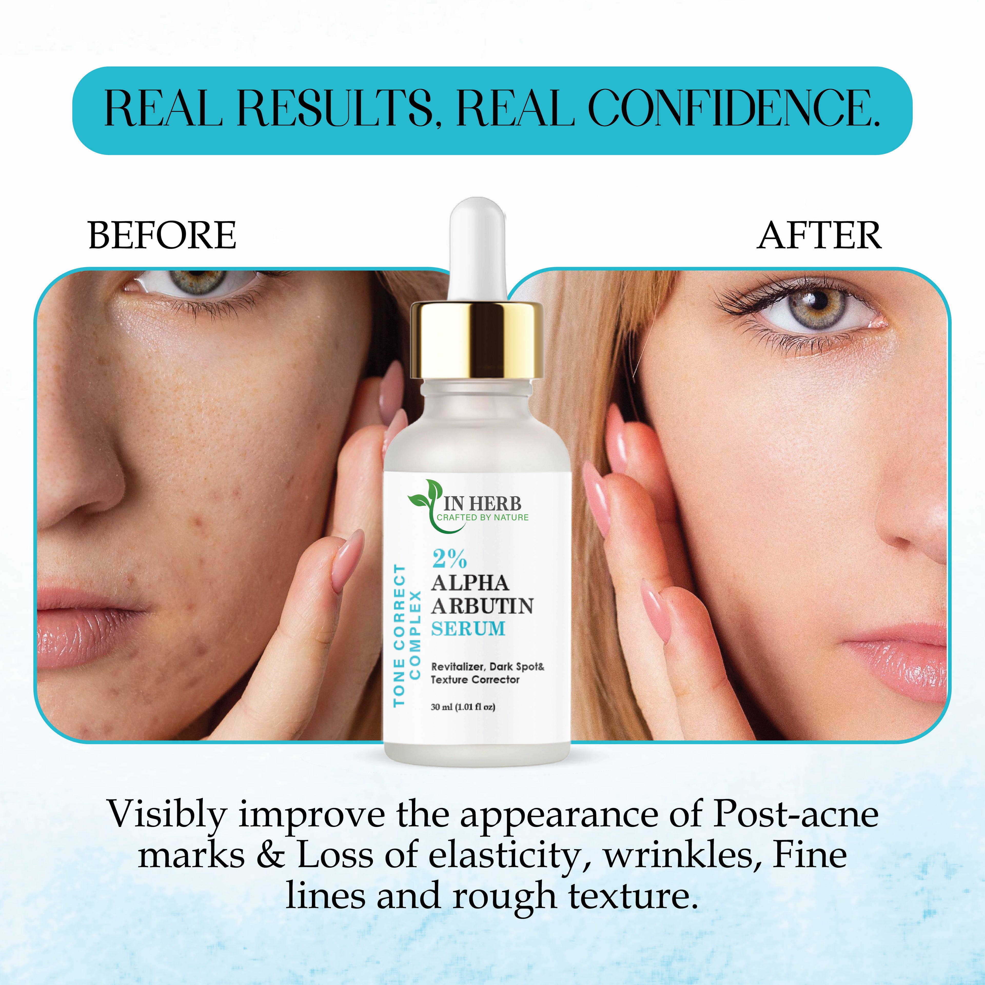 In Herb 2% Alpha Arbutin Serum for Face, Lightweight Daily Use, 30 ml