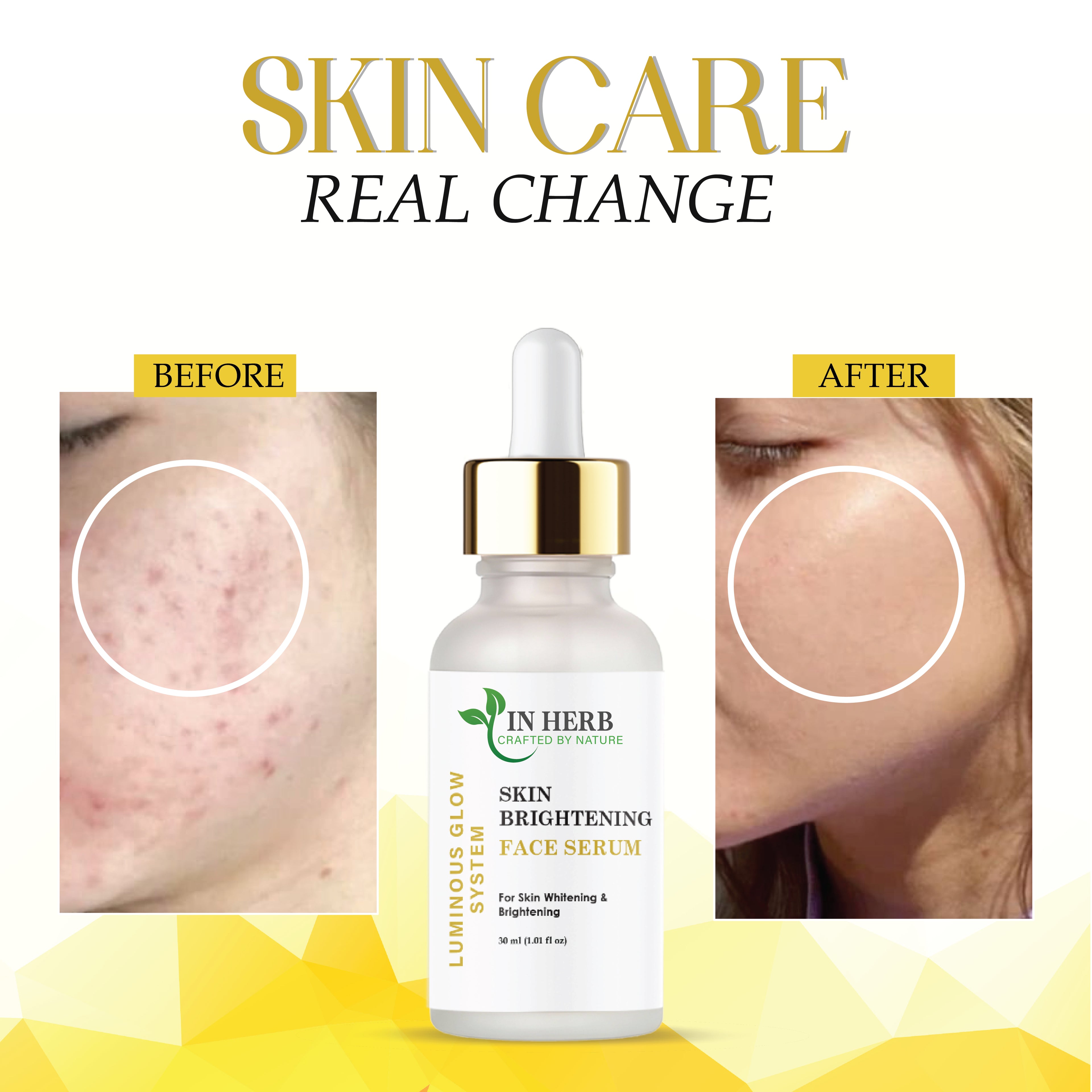 IN HERB Skin Brightening Face Serum, AQUA, Aloe Vera extract 5%, Licorice extract 1%, For Skin Whitening & Brightening, 30ml (1.01 fl oz)