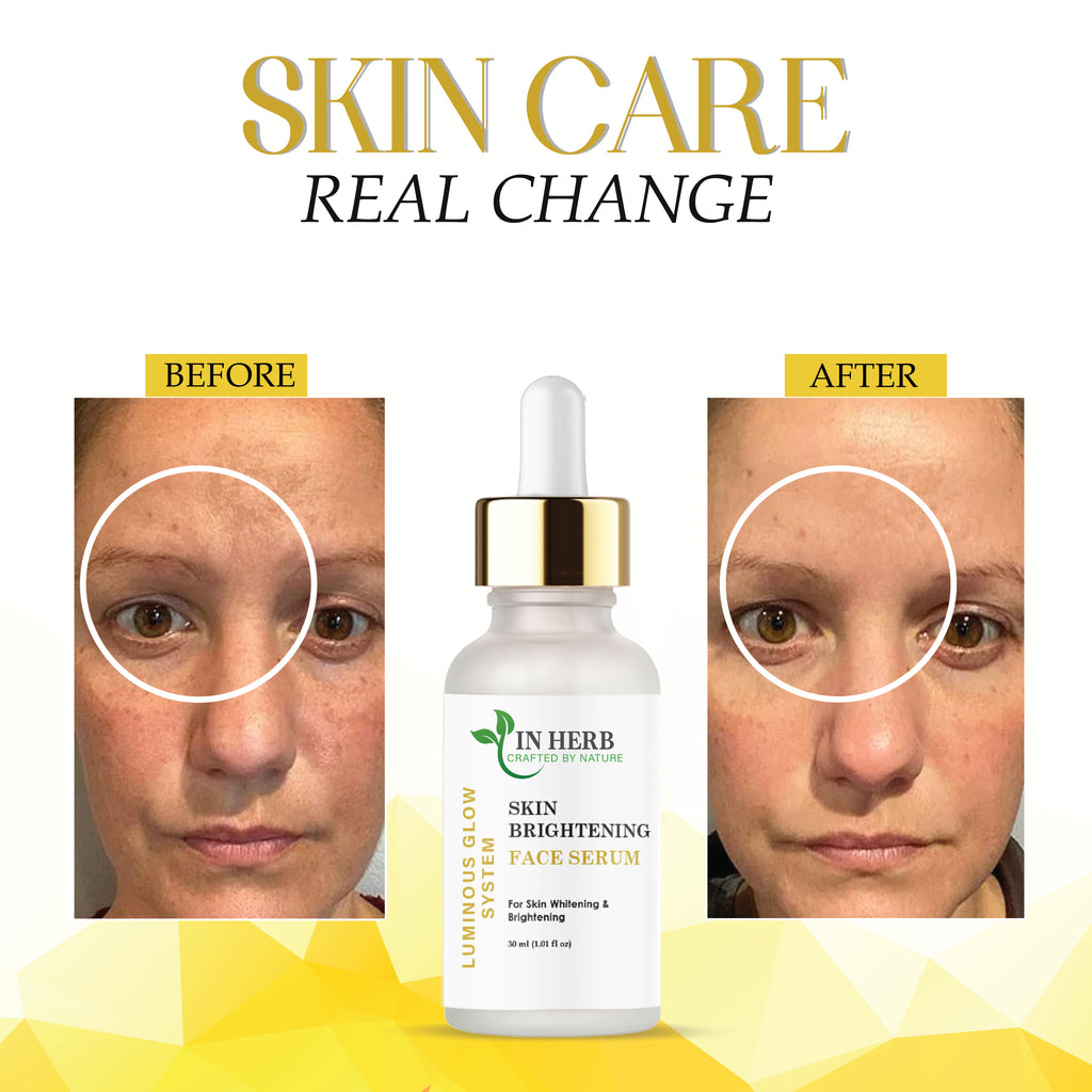 IN HERB Skin Brightening Face Serum, AQUA, Aloe Vera extract 5%, Licorice extract 1%, For Skin Whitening & Brightening, 30ml (1.01 fl oz)