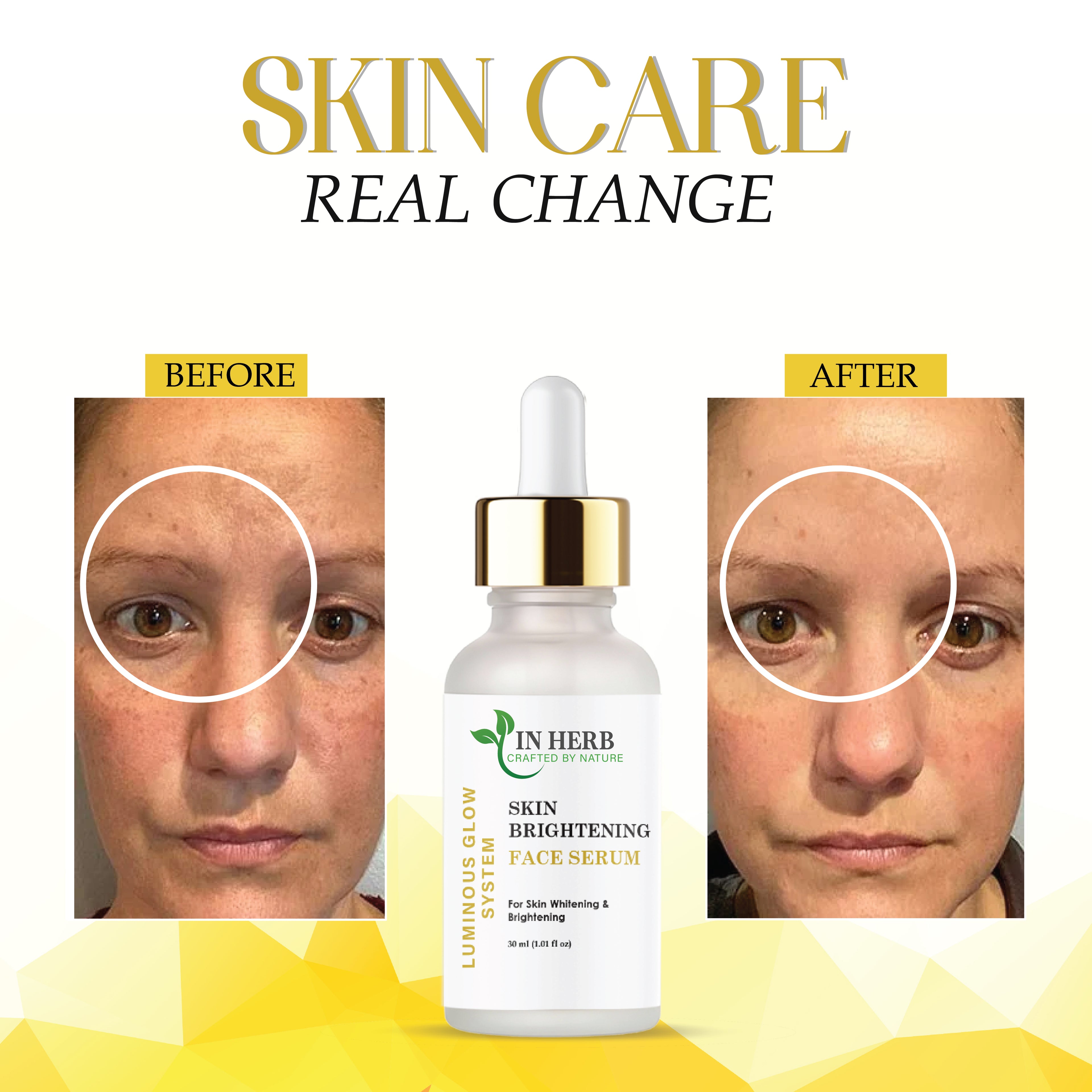 IN HERB Skin Brightening Face Serum, AQUA, Aloe Vera extract 5%, Licorice extract 1%, For Skin Whitening & Brightening, 30ml (1.01 fl oz)