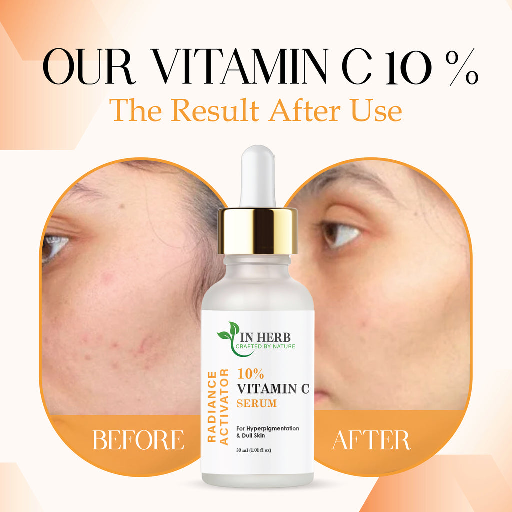 IN HERB Vitamin C 15% Serum for Hyperpigmentation & Dull Skin, 30ml (1.01 fl oz)