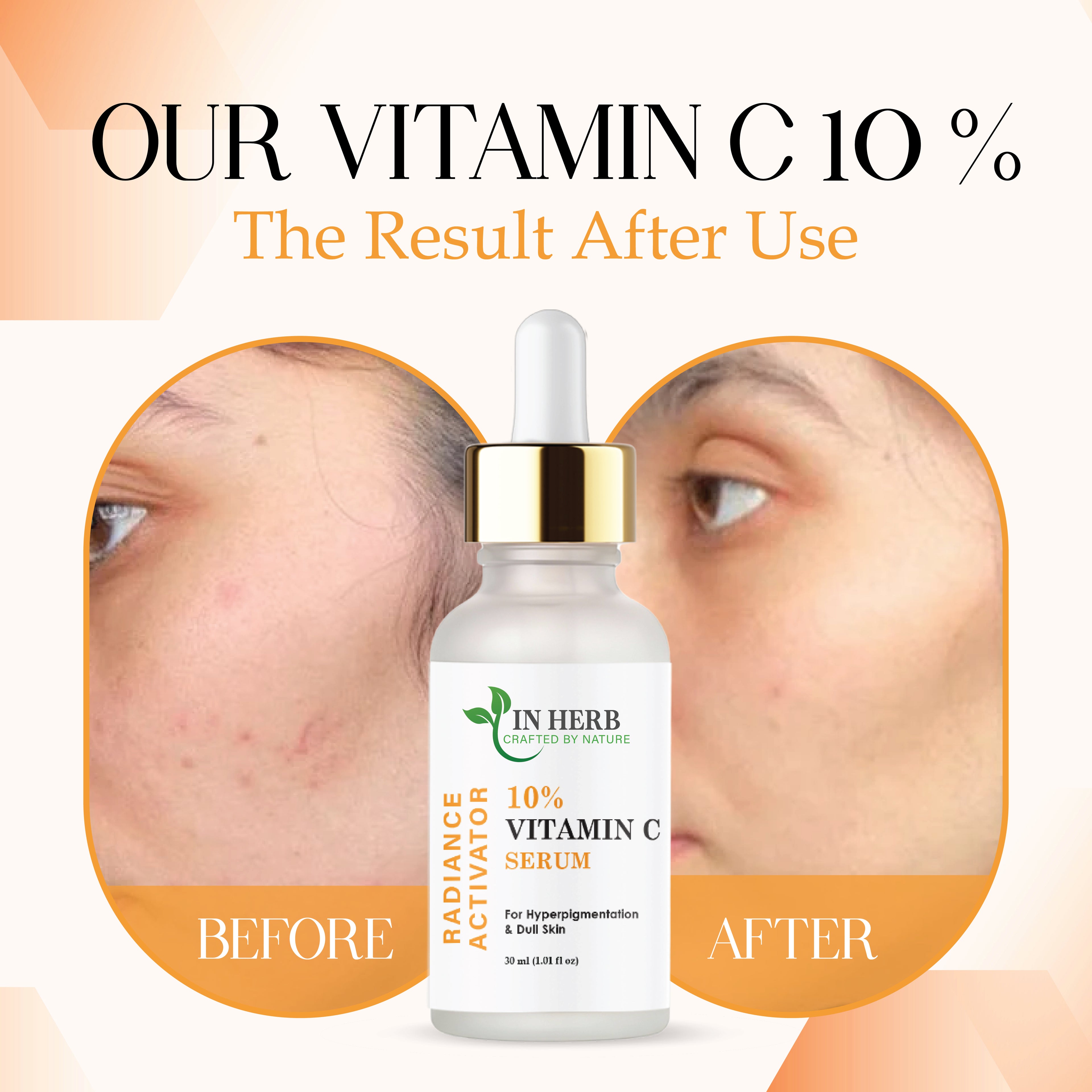 IN HERB Vitamin C 15% Serum for Hyperpigmentation & Dull Skin, 30ml (1.01 fl oz)